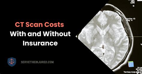 Factors That Determine CT Scan Costs