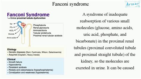 Fanconi Syndrome: