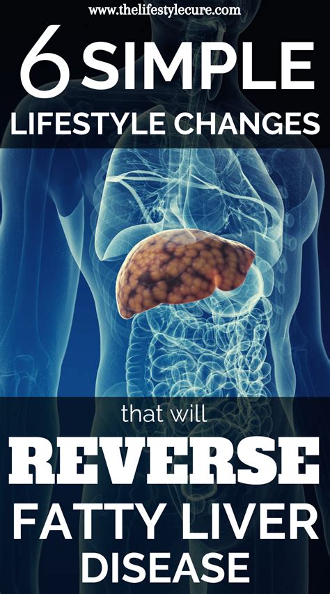 Fatty Liver: You Can Reverse It Kindle Editon