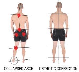 Fears of Poor Alignment: Unlocking the Hidden Pain Points