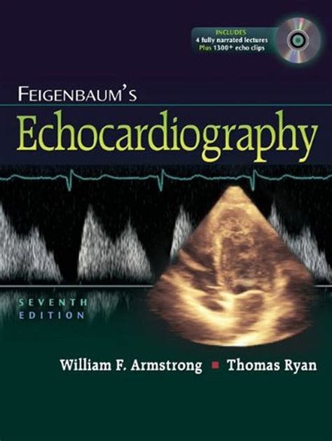 Feigenbaums Echocardiography (w/DVD) Ebook Doc