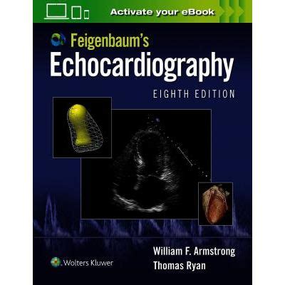 Feigenbaums Echocardiography (w/DVD) Ebook Doc