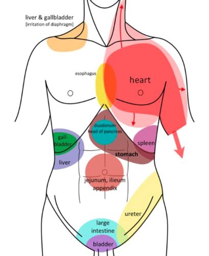 Female Gallbladder Referred Pain Chart