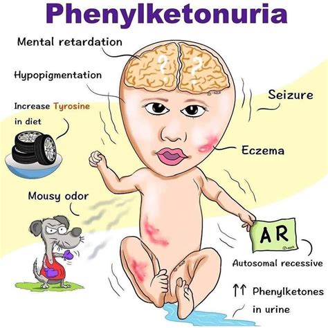 Fenilcetonúria (PKU)