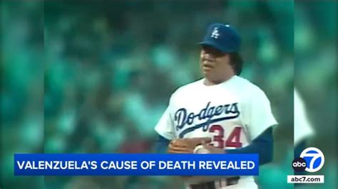 Fernando Valenzuela's Cause of Death: Unraveling the Mystery