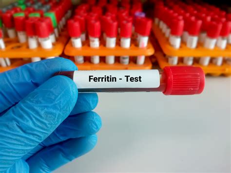 Ferritin