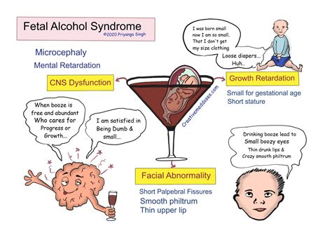 Fetal Alcohol Syndrome, Fetal Alcohol Effects: Ebook Kindle Editon