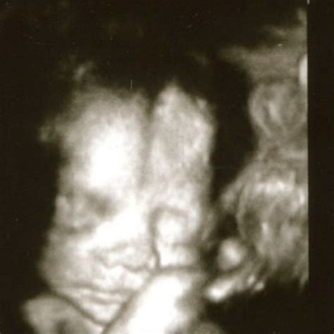 Fetal Development at 23 Weeks