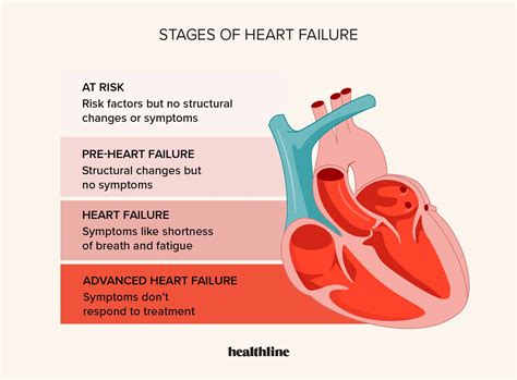 Final Stages of Heart Failure: A 10-Phase Journey to the End