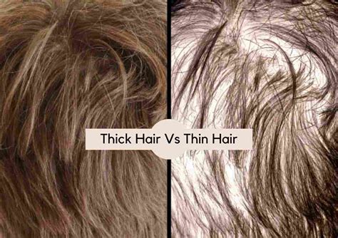 Fine vs. Thick Scalp: A Detailed Comparison of Hair Thickness and Scalp Characteristics