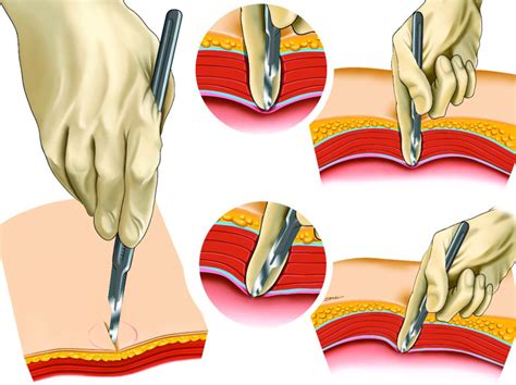 Fingertip Technique: