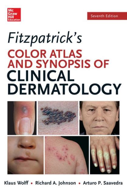 Fitzpatrick s Color Atlas and Synopsis of Clinical Dermatology Seventh Edition Color Atlas and Synopsis of Clinical Dermatology Fitzpatrick Doc