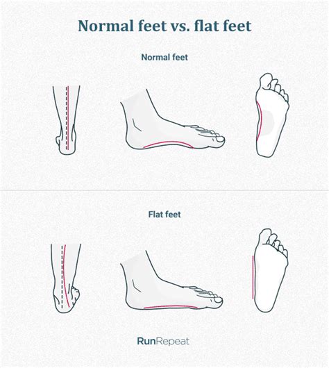 Flat Feet Running Shoes: A Comprehensive Guide for Optimal Support and Performance