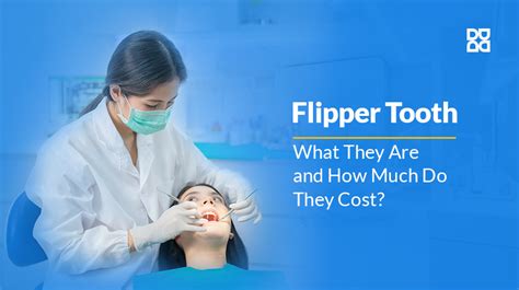 Flipper Tooth Cost Without Insurance: Your Ultimate Guide