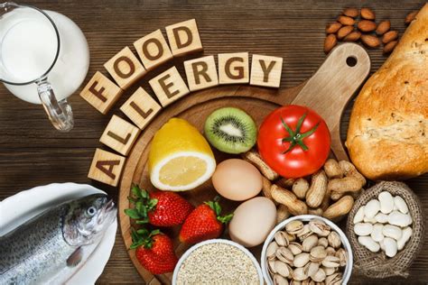 Food allergies or sensitivities: