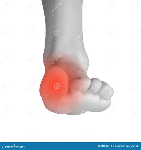 Foot Pain and Discomfort: