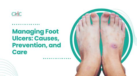 FootsieGalore: A Comprehensive Guide to Understanding and Managing Foot Health