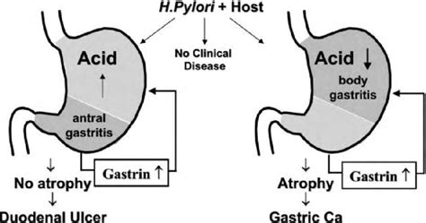 Gastroduodenal Disease and Helicobacter Pylori Pathophysiology Kindle Editon