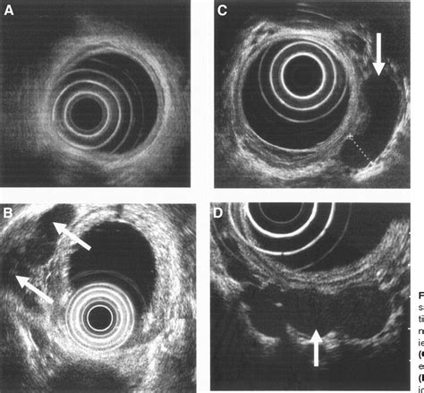 Gastrointestinal Endosonography Kindle Editon