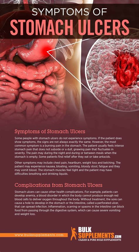 Gastrointestinal Ulcers: