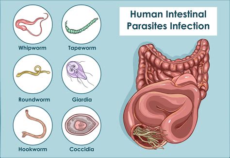 Gastrointestinal parasites: