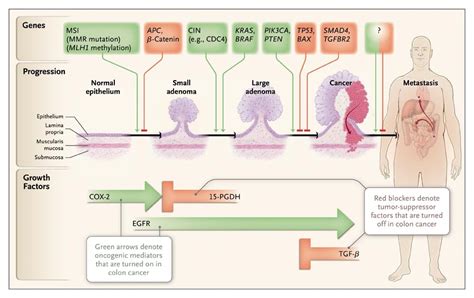 Genetics of Colorectal Cancer Kindle Editon