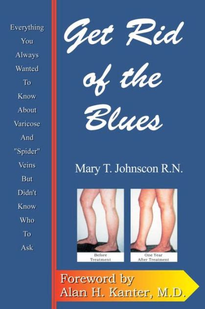 Get Rid of the Blues Everything you always wanted to know about Varicose and Spider Veins But Didn t Know Who to Ask Kindle Editon