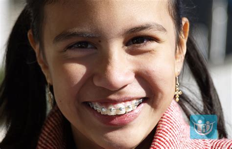 Getting Used to Playing with Braces