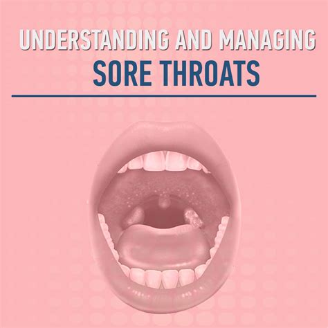 GlooThroat: A Comprehensive Guide to Understanding and Managing Sore Throats