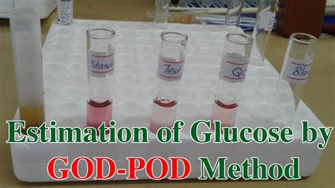 Glucose Estimation by GOD-POD Method: