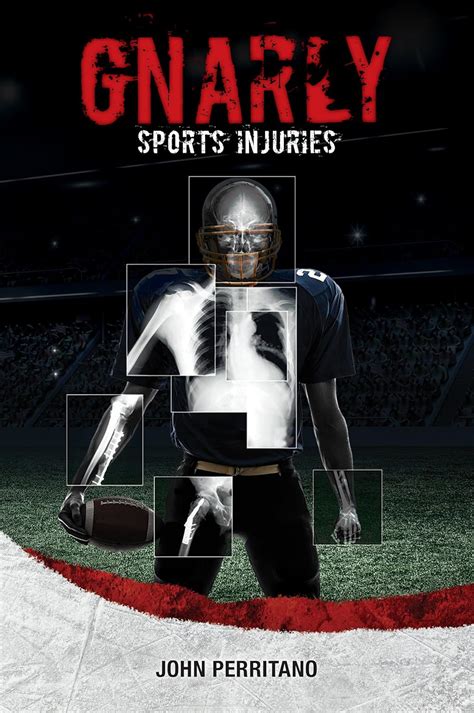 Gnarly Sports Injuries Red Rhino Nonfiction