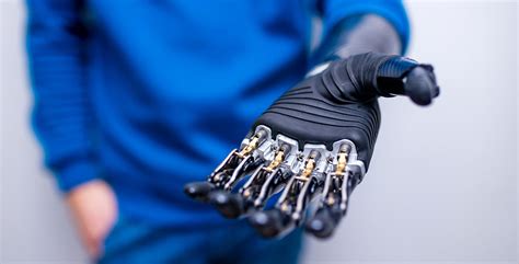 Gorilla Arm: Revitalizing Limb Prosthetics Through the Convergence of Human and Machine