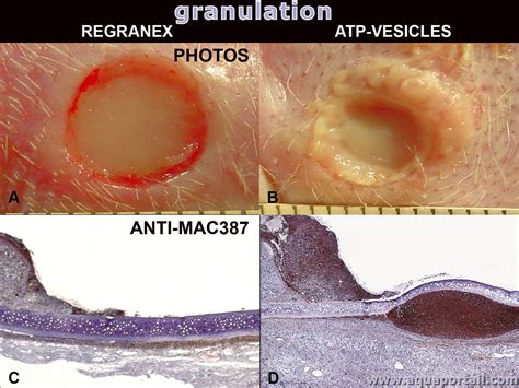 Granulation: