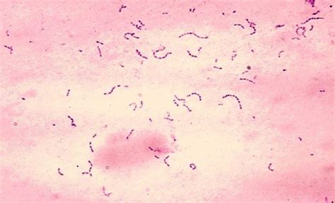 Group A Beta Hemolytic Streptococcus (GABHS)