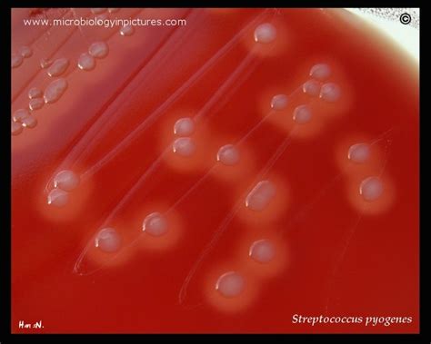 Group A Beta-Hemolytic Streptococcus: A Comprehensive Review