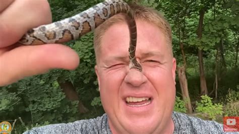 Guys with Snake Bites: 12 Jaw-Dropping Cases You Won't Believe!