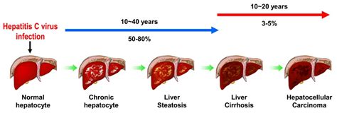 HCV and Related Liver Diseases Doc