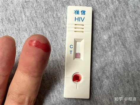 HIV 检测：了解窗口期