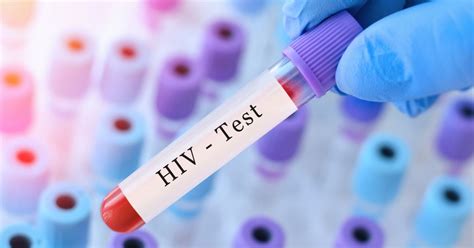 HIV Test Singapore: Know Your Status in 3 Easy Steps