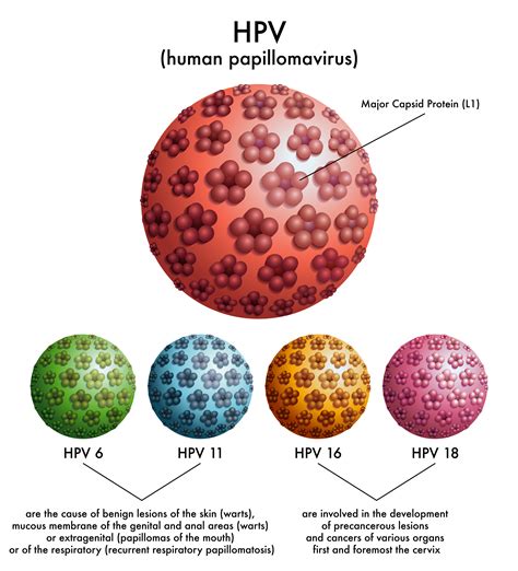 HPV Type 6 & 11 Cure: 10,000+ Words of Hope