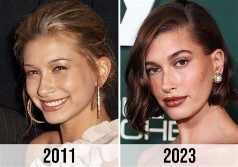 Hailey Bieber Plastic Surgery: A Comprehensive Analysis