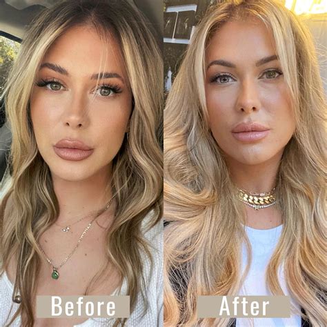 Hair Extensions Before and After: 5 Ways To Transform Your Look