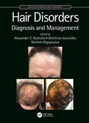 Hair Growth and Disorders 1st Edition Doc
