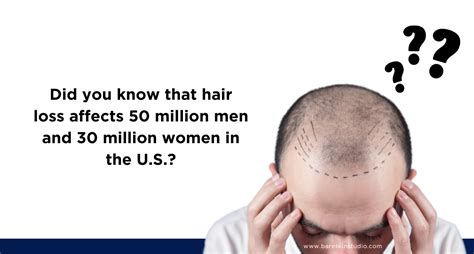 Hair Loss Affects Millions