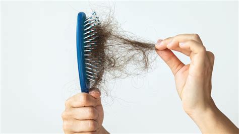 Hair Loss Concerns: