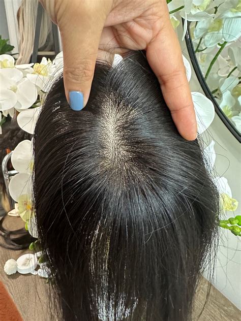 Hair Loss on Top of Head: 3 Ways to Get It Back