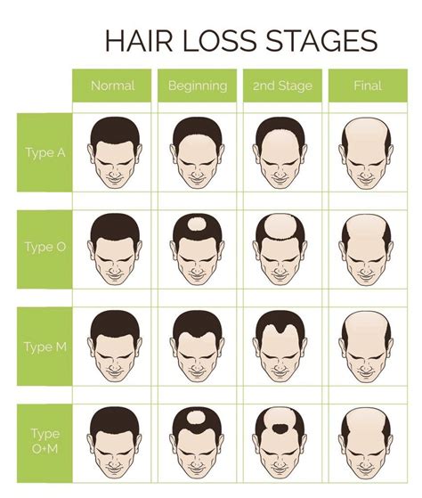 Hair Loss on Top of Head: 7 Shocking Statistics to Know