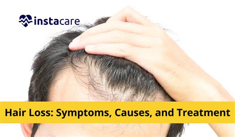 Hair Loss on Top of Head: Causes, Symptoms, and Solutions