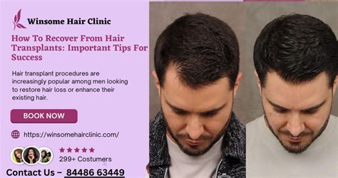 Hair Replacement Hair: 5 Sensational Secrets to Restore Your Confidence