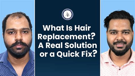 Hair Replacement Hair: The Ultimate Guide to Regaining Confidence and Youthfulness